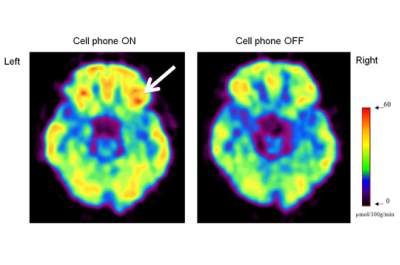 Η ακτινοβολία 4G των τηλεφώνων επηρεάζει τον εγκέφαλο